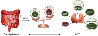 Gut Microbiome and the Role of Metabolites in the Study of Graves’ Disease